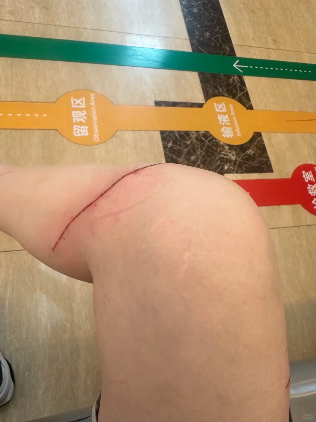 我儿下手是真狠啊