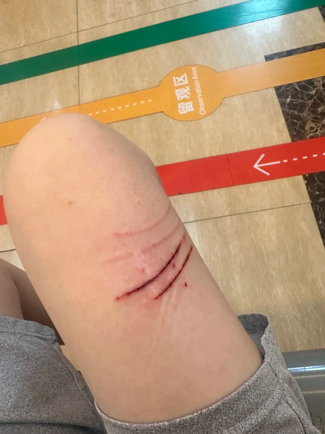 我儿下手是真狠啊